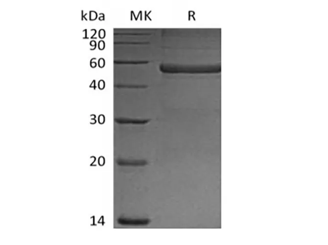 Recombinant Mouse Pentraxin-related protein PTX3(N-6His) - image 1