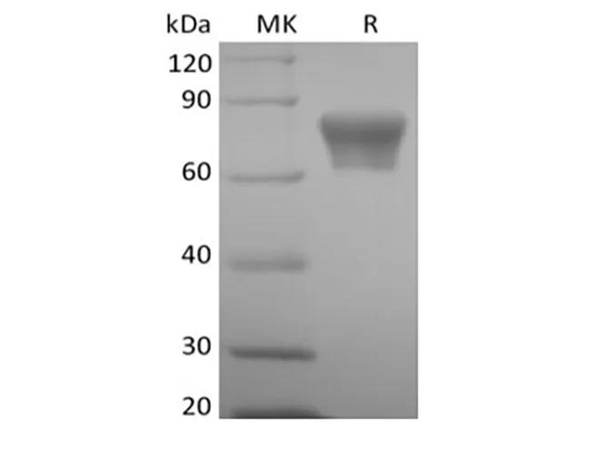 Recombinant Mouse TNF Receptor II/TNF RII/TNFRSF1B/CD120b (C-Fc) - image 1