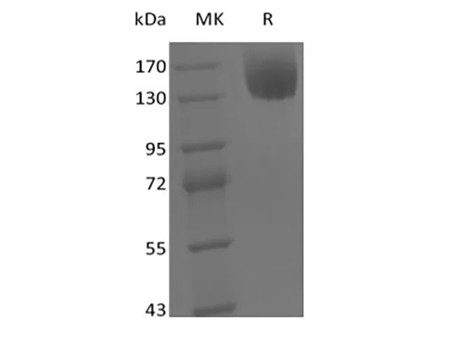 Recombinant Mouse Leptin Receptor/LEPR/CD295 (C-Fc) - image 1