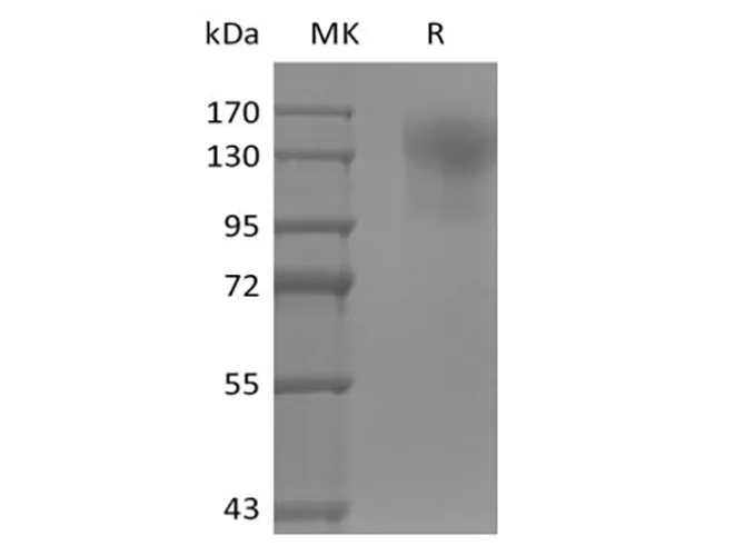 Recombinant Mouse CD45/PTPRC (C-6His) - image 1