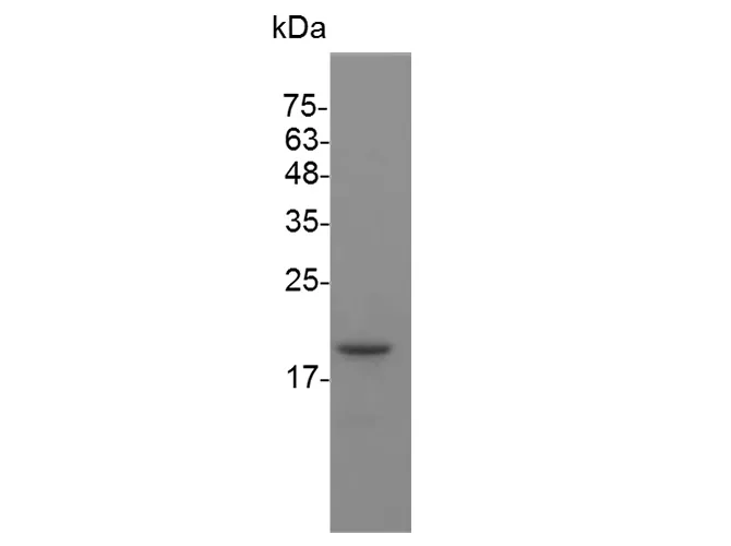 Recombinant Mouse IFN beta 1a protein(His Tag) - image 1