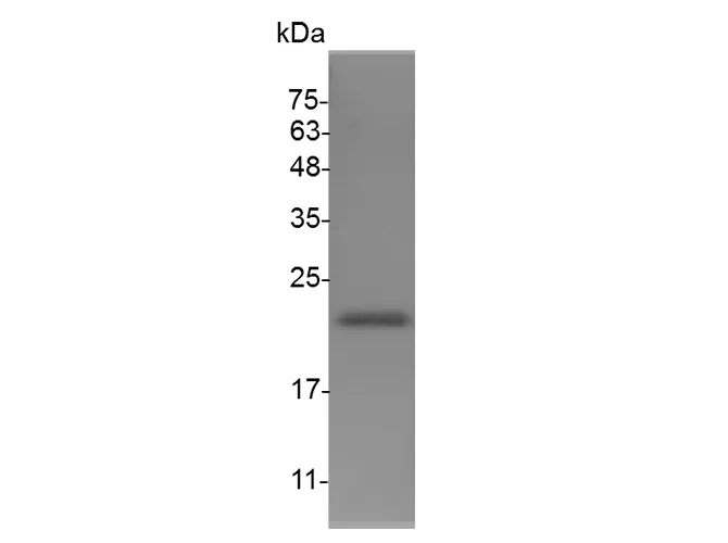 Recombinant Mouse G-CSF protein(N-His) - image 1