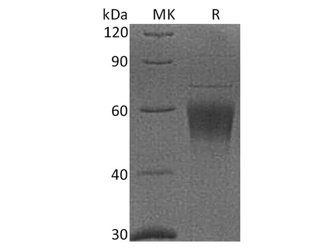 Recombinant Cynomolgus CRTAM/CD355 Protein (His Tag) - image 1