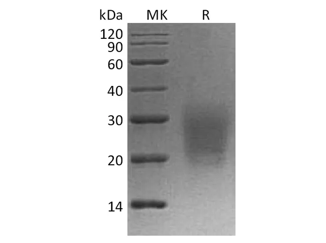 Recombinant Cynomolgus CD3d/CD3 delta Protein (His Tag) - image 1