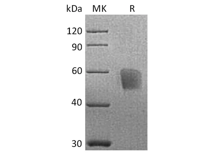 Recombinant Cynomolgus CD3d/CD3 delta Protein (Fc Tag) - image 1