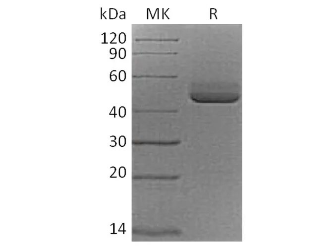 Recombinant Cynomolgus TIGIT/VSIG9/VSTM3 Protein (Fc Tag) - image 1