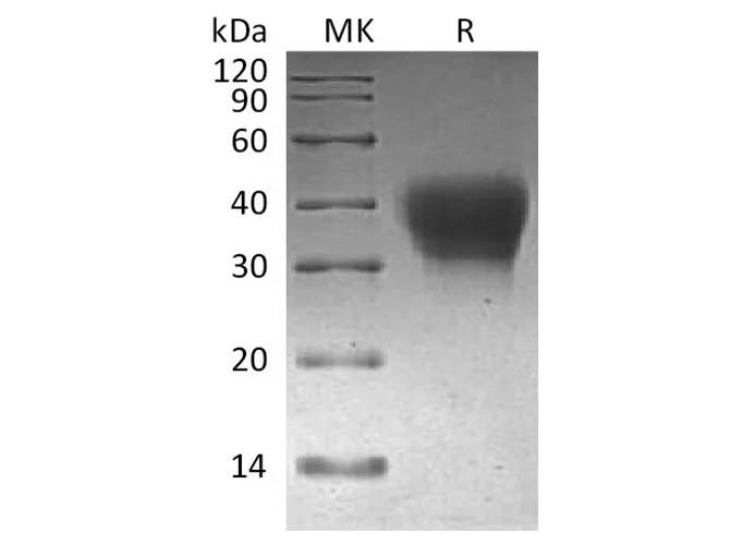 Recombinant Cynomolgus PD-1/CD279/PDCD1 Protein (His Tag) - image 1