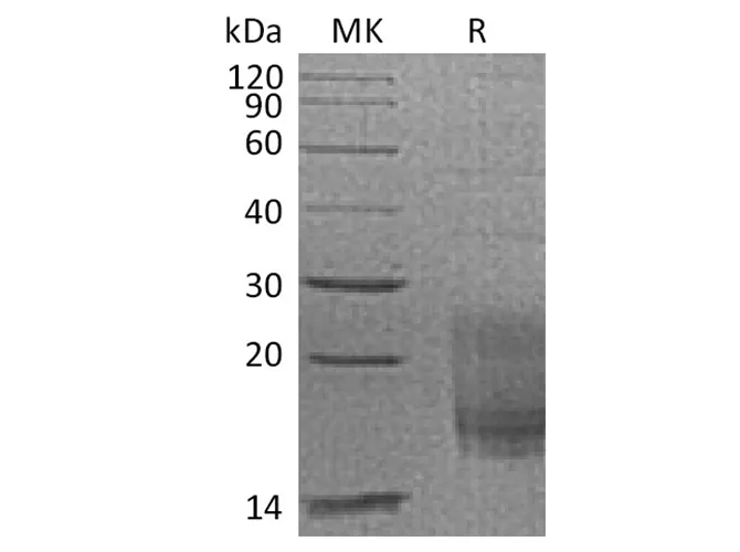 Recombinant Cynomolgus TIGIT/VSIG9/VSTM3 Protein (His Tag) - image 1