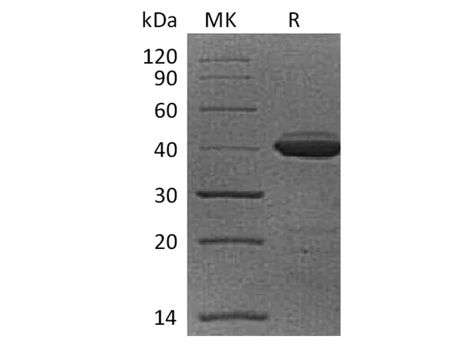 Recombinant Cynomolgus B2M/Beta-2-microglobulin Protein (Fc Tag) - image 1
