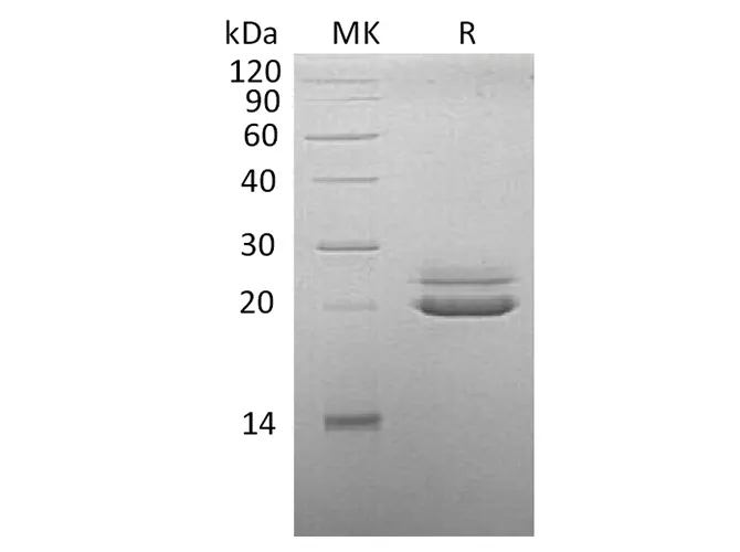 Recombinant Cynomolgus FGF-21/Fibroblast Growth Factor 21 Protein (His Tag) - image 1