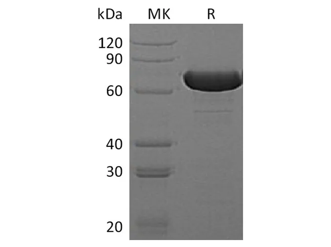 Recombinant E.coli Beta-Glucuronidase/Uida/Beta-Gus Protein (His Tag) - image 1