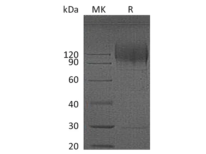 Recombinant HIV Recombinant HIV gp120 Protein (His Tag) - image 1
