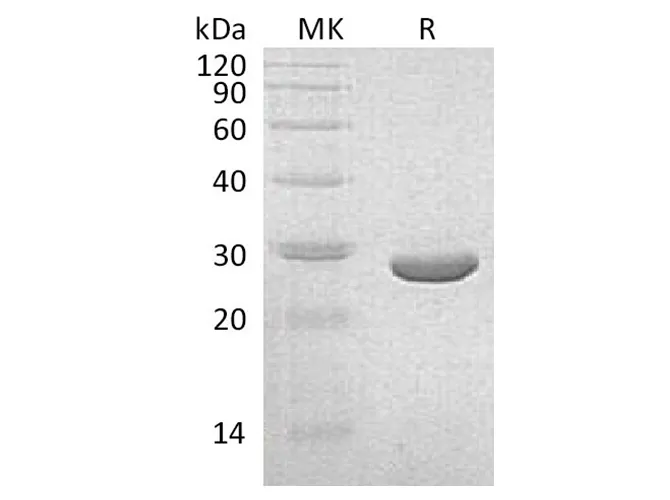Recombinant Klebsiella pneumoniae NEO Protein - image 1