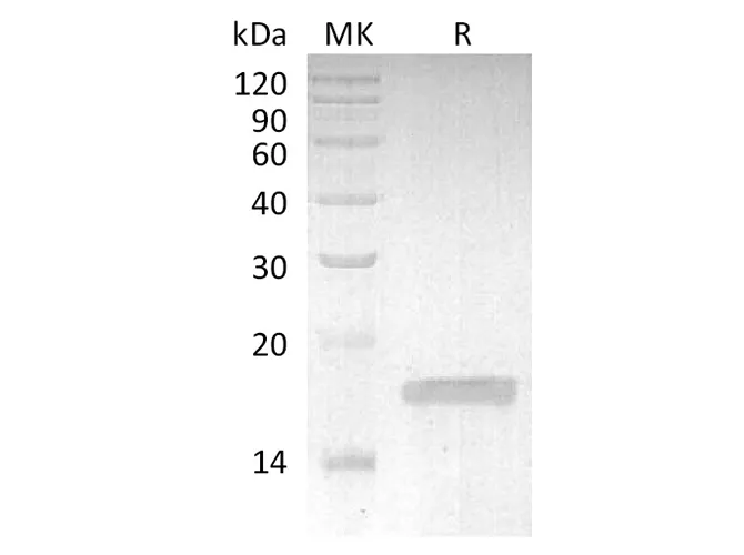 Recombinant Rabbit TNF-alpha/TNFSF2/TNFa Protein - image 1