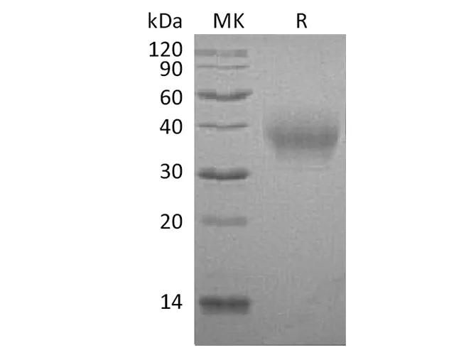 Recombinant Rabbit B7-1/CD80 Protein (His Tag) - image 1