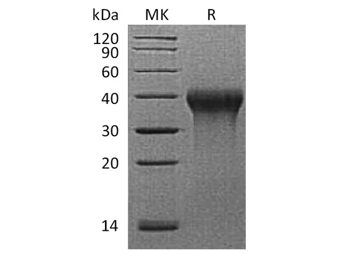 Recombinant Rhesus macaque CD27/TNFRSF7 Protein (His Tag) - image 1