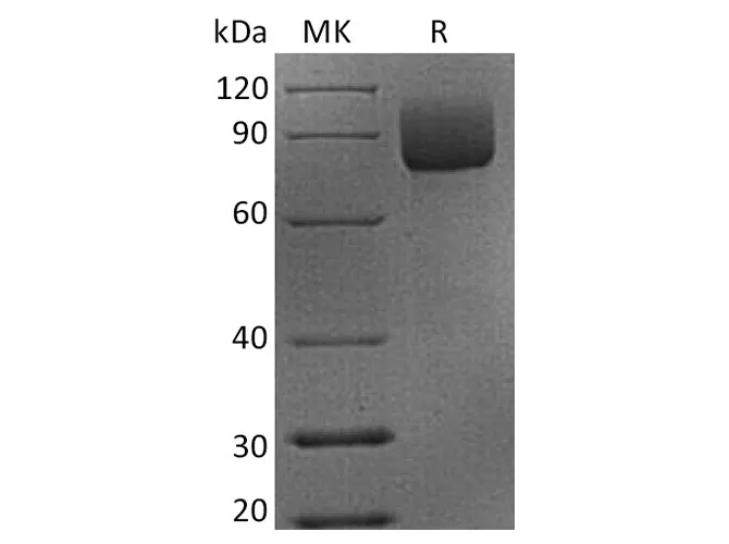 Recombinant Rhesus macaque CD19 Protein (Fc Tag) - image 1