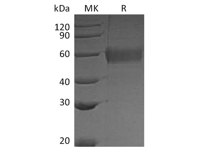 Recombinant Vaccinia virus Soluble Interferon α/β Receptor B18 Protein (His Tag) - image 1