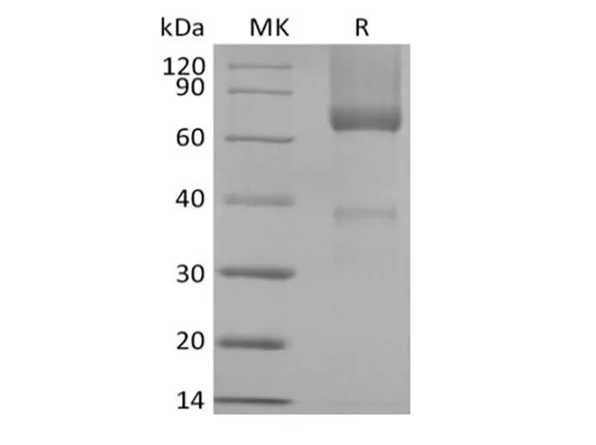 Recombinant Rhesus Macaque Glypican-3/GPC3/OCI5 (C-6His) - image 1