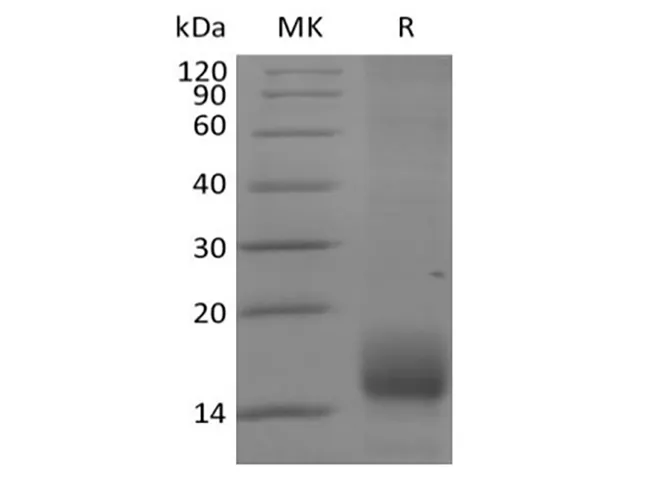 Recombinant Cynomolgus BCMA/TNFRSF17 (C-6His) - image 1