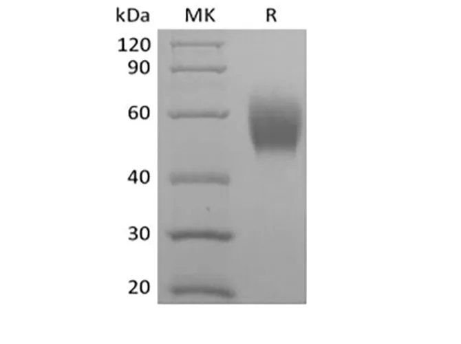 Recombinant Cynomolgus Signal-Regulatory Protein alpha-1/SIRPA/CD172a (C-6His) - image 1