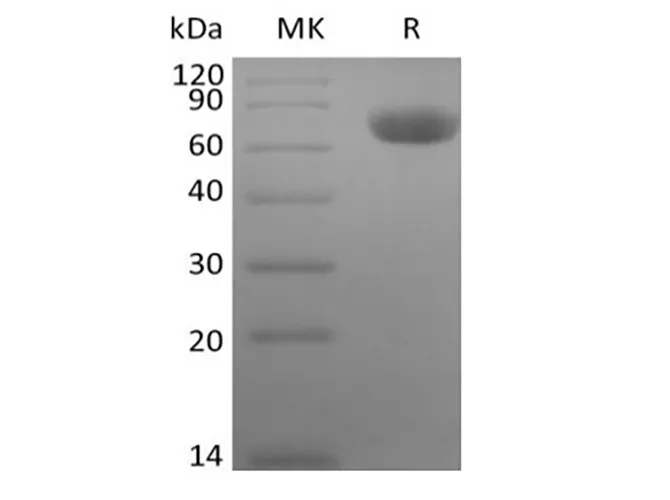Recombinant Rhesus Macaque TNF Receptor II/TNF RII/TNFRSF1B/CD120b (C-Fc) - image 1