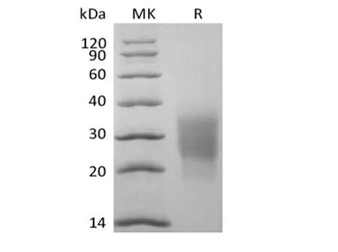 Recombinant Cynomolgus NKG2-D type II Integral Membrane Protein/NKG2D/CD314 (N-6His) - image 1