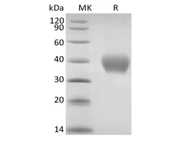 Recombinant Rhesus Macaque TNF Receptor II/TNF RII/TNFRSF1B/CD120b (C-6His) - image 1