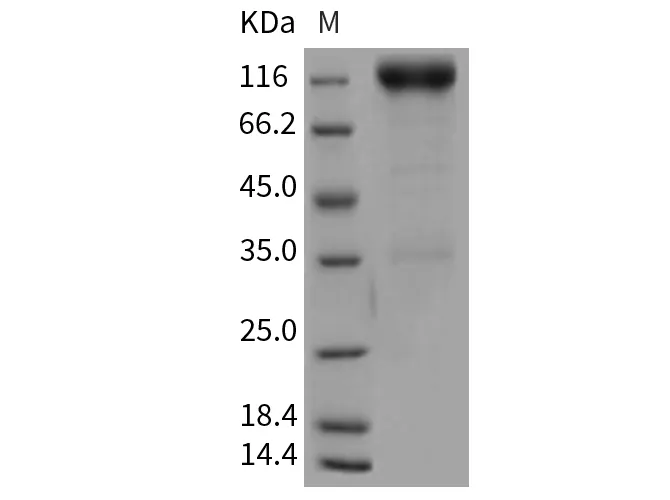 Recombinant Rat PDGFRB/CD140b Protein (Fc Tag) - image 1