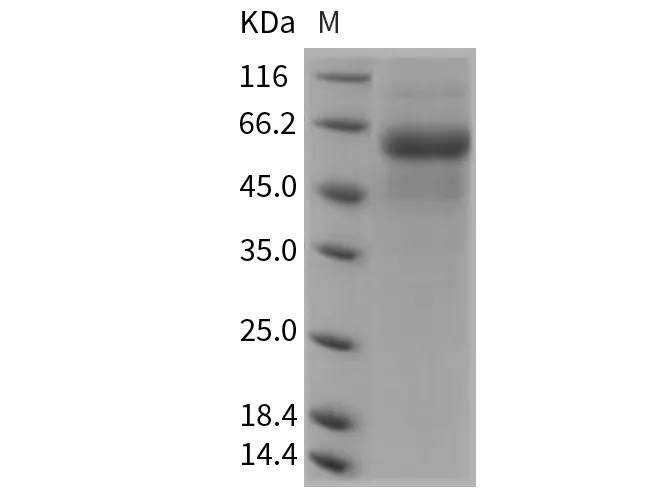 Recombinant Rat DDR2 Kinase/CD167b Protein (His Tag) - image 1