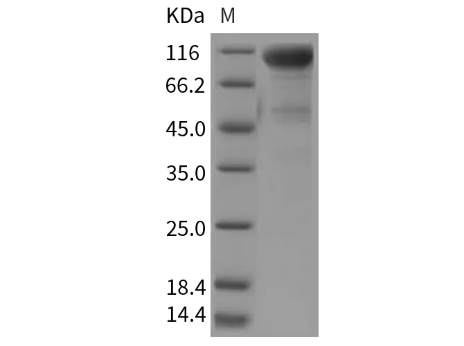 Recombinant Rat DDR2 Kinase/CD167b Protein (Fc Tag) - image 1