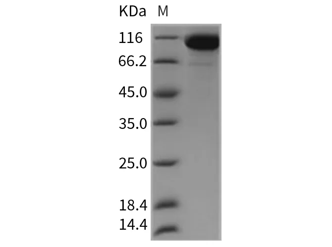 Recombinant Rat Semaphorin 4D/SEMA4D/ Protein (His Tag) - image 1