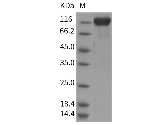 Recombinant Rat Semaphorin 4D/SEMA4D/CD100 Protein (Fc Tag) - image 1