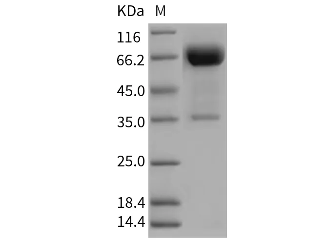 Recombinant Rat OLR1/LOX1 Protein (Fc Tag) - image 1