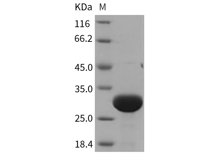 Recombinant Rat UCHL3/UCH-L3 Protein (His Tag) - image 1