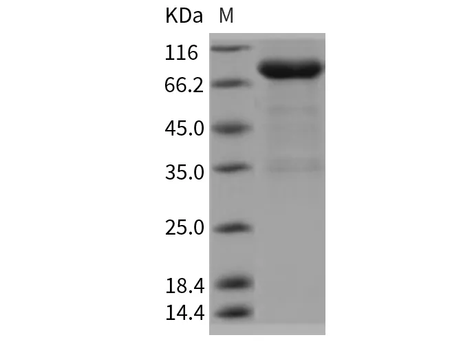 Recombinant Rat UNC5B/UNC5H2 Protein (Fc Tag) - image 1