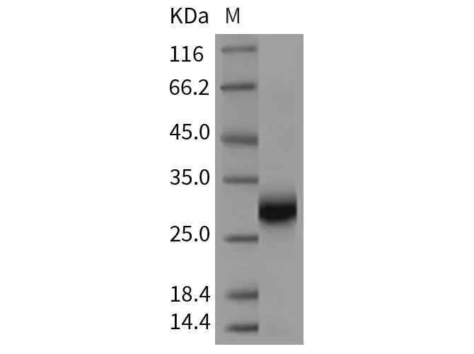 Recombinant Rat TIMP-1/TIMP1 Protein - image 1