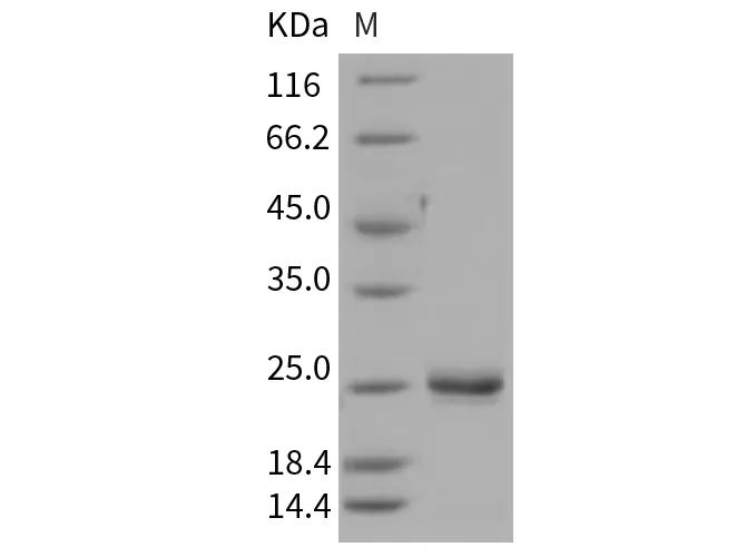 Recombinant Rat LCN2/NGAL Protein (His Tag) - image 1