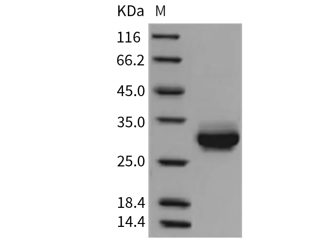 Recombinant Rat CRP/C-Reactive Protein (His Tag) - image 1