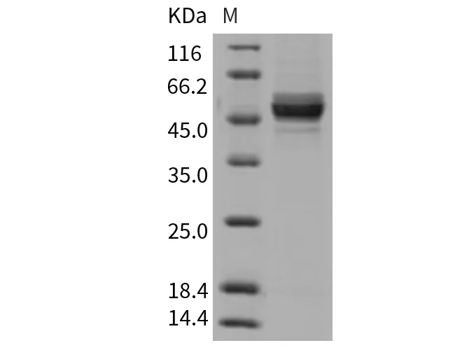 Recombinant Rat GPT2 Protein (His Tag) - image 1