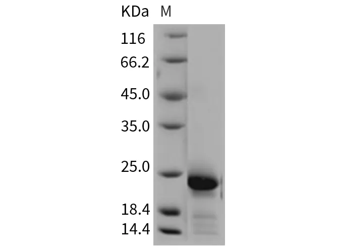 Recombinant Rat IL-6/Interleukin-6 Protein - image 1