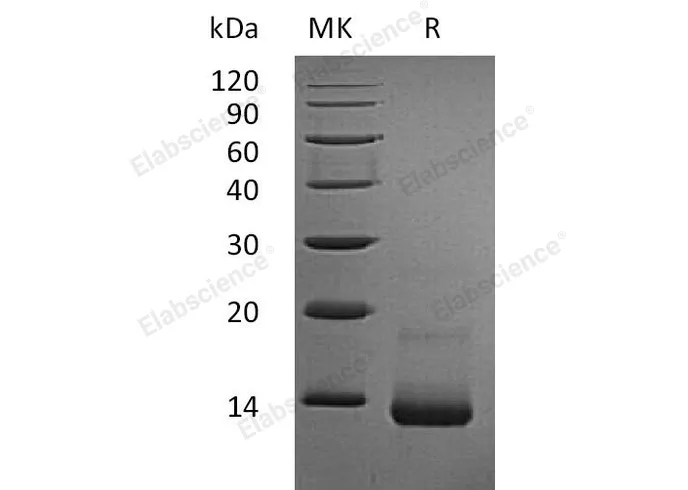 Recombinant Rat CCL5/RANTES Protein (His Tag) - image 1