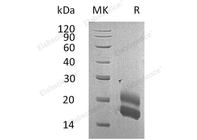 Recombinant Rat GM-CSF/CSF2 Protein (His Tag) - image 1