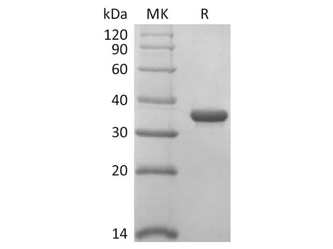 Recombinant SARS-CoV-2 Papain-Like Protease Protein - image 1