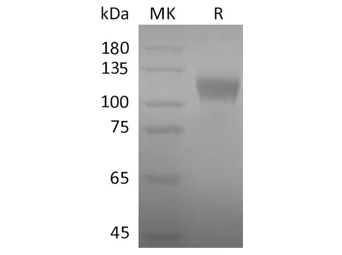 Recombinant SARS-CoV-2 S1 Protein - image 1
