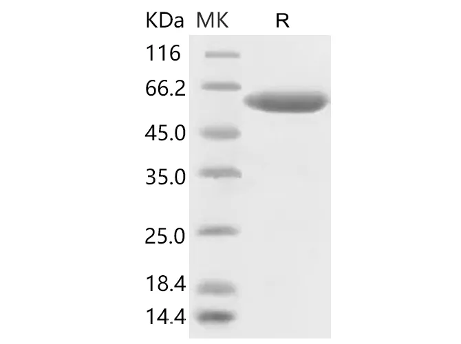 Recombinant SARS-CoV-2 Spike Protein (RBD, mFc Tag) - image 1