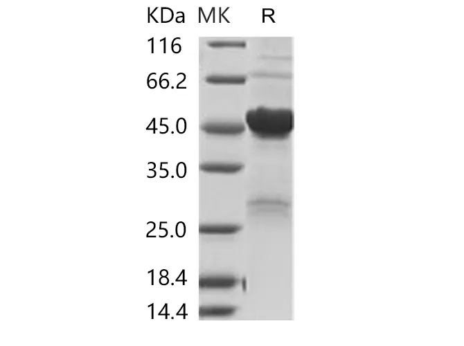 Recombinant SARS-CoV-2 Nucleoprotein / NP Protein (His Tag) - image 1