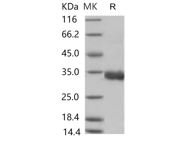 Recombinant SARS-CoV-2 Spike/RBD Protein (RBD, His Tag) - image 1