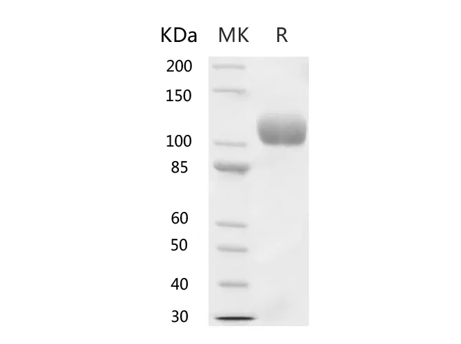 Recombinant Human ACE2 Protein (His Tag) - image 1