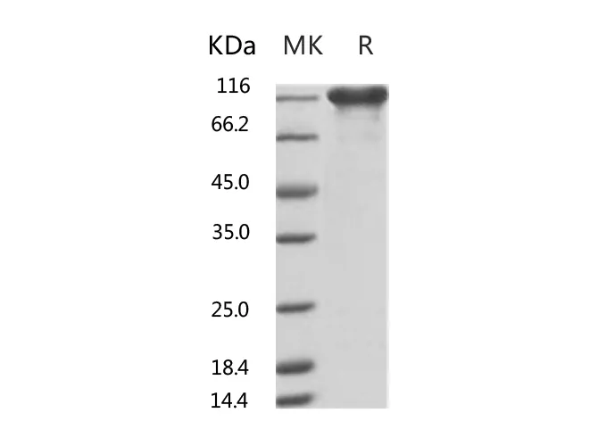 Recombinant Human ACE2 Protein (mFc Tag) - image 1